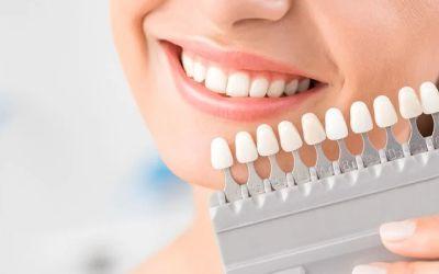 IMPLANTES
