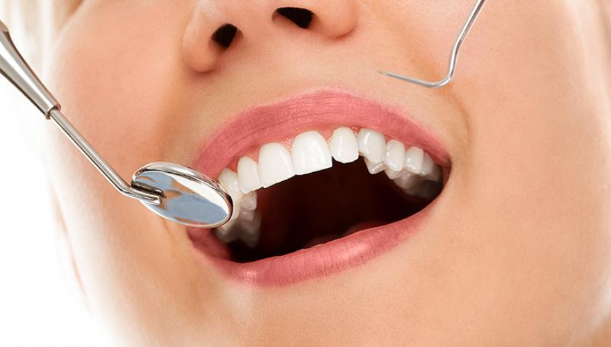 Como escolher um melhor dentista?