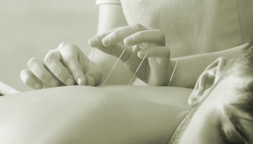 Técnica de acupuntura: descubra as maravilhas desse tratamento